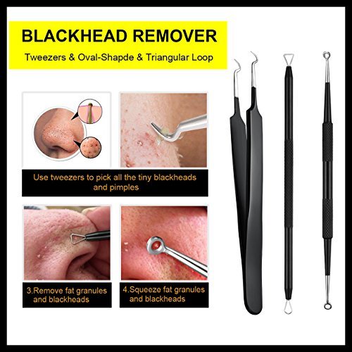 Blackhead Remover Tweezer Kit, ElleSye 6-PCS Pimple Comedone Extractor, Blackhead Whitehead Blemish Acne Zit Removal Tool for Risk Free Nose...