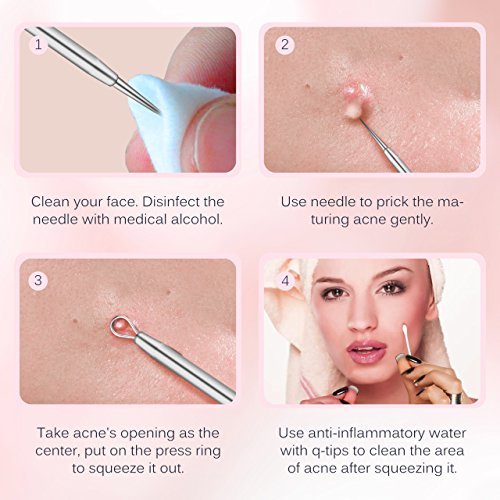 ElleSye Blackhead Remover Kit, 5-in-1 Pimple Extractor Acne Comedone Blackhead Removal Tool Set, Treatment for Blemish, Whitehead, Zit Removing with...