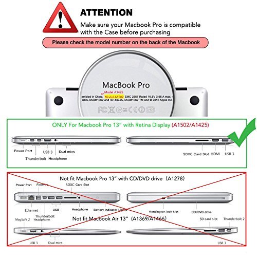 Mosiso Plastic Hard Case with Keyboard Cover with Screen Protector Only for MacBook Pro 13 Inch with Retina Display No CD-Rom (A1502/A1425, Version 2015/2014/2013/2012), Rose Gold