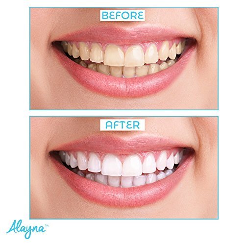 Professional Strength Tooth Polisher & Whitener by Alayna, Removes Surface Stains