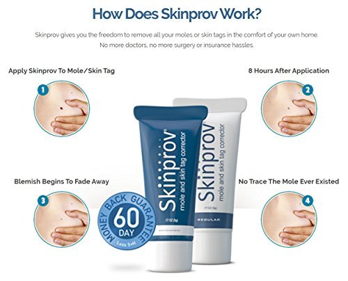 SKINPROV Advanced Mole & Skin Tag Remover - Removes 10 Moles or Skin Tags (FAST...